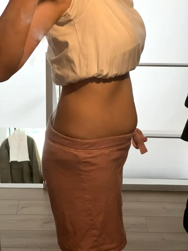 UNDEUX SUPERBODY LIFEの4ヶ月トレーニングで変化したお腹（右側）の経過写真。反り腰改善と下腹の引き締まりが分かる（LYFTOFF-WOMANオリジナル）。