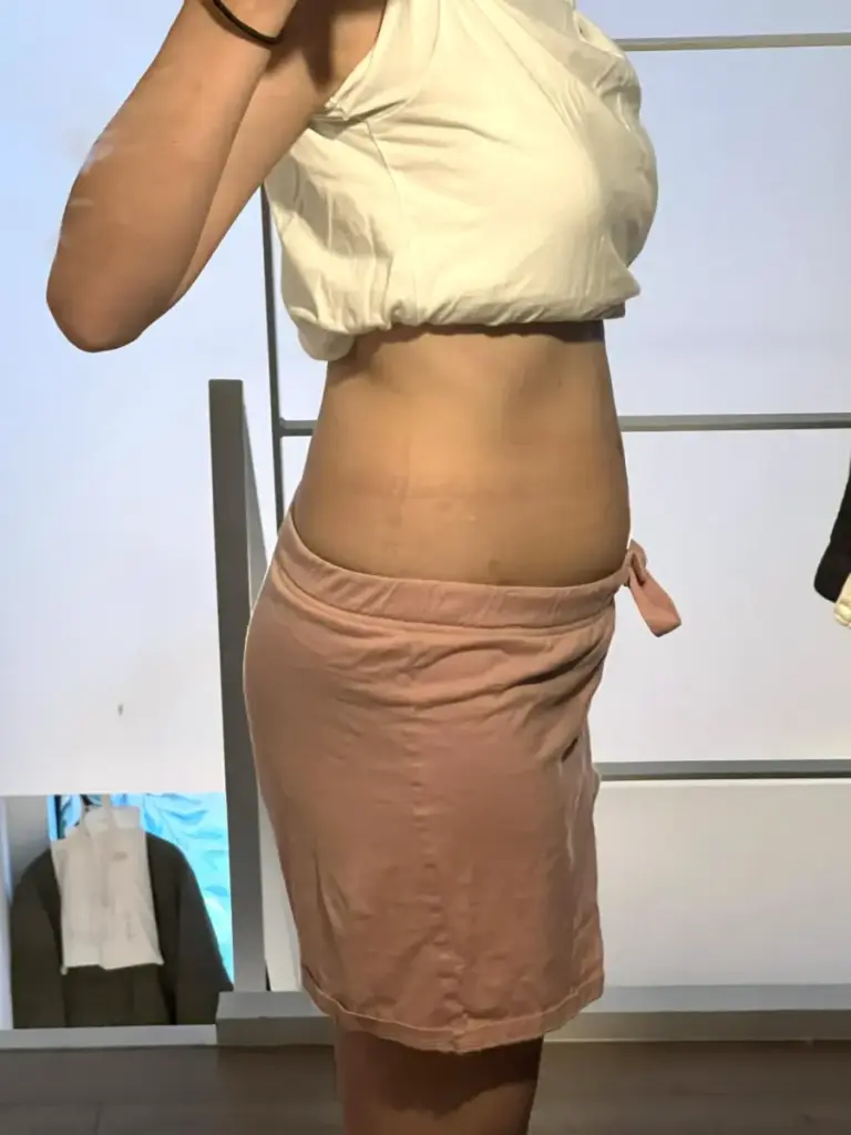 UNDEUX SUPERBODY LIFEの4ヶ月トレーニングで変化したお腹（右側）の経過写真。反り腰改善と下腹の引き締まりが分かる（LYFTOFF-WOMANオリジナル）。