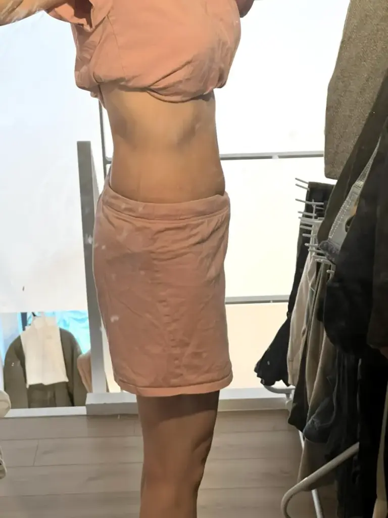 UNDEUX SUPERBODY LIFEの4ヶ月トレーニングで変化したお腹（右側）の経過写真。反り腰改善と下腹の引き締まりが分かる（LYFTOFF-WOMANオリジナル）。