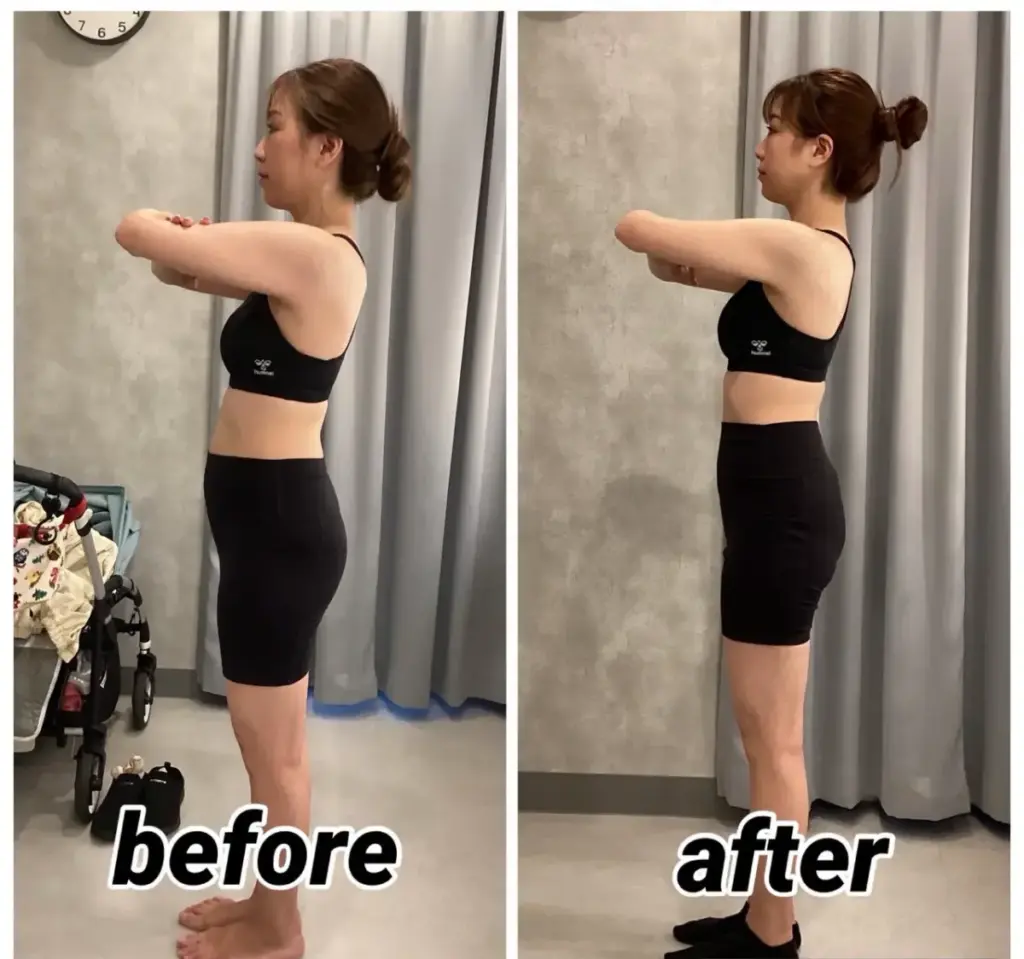 UNDEUX SUPERBODY LIFEに4ヶ月通った編集部スタッフの横向きビフォーアフター。姿勢が安定し、お腹周りが引き締まった変化（LYFTOFF-WOMAN編集部オリジナル）
