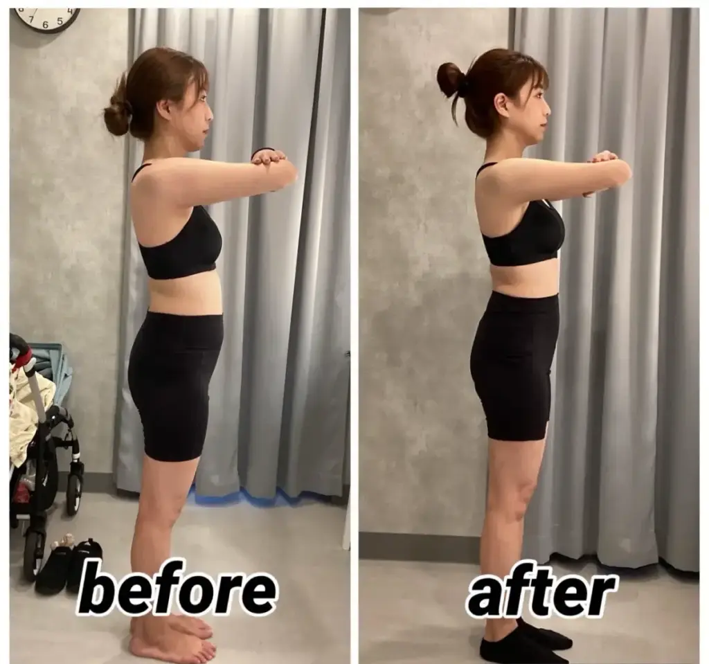 UNDEUX SUPERBODY LIFEで4ヶ月トレーニングした結果、反り腰と下腹が大きく改善した横向きビフォーアフター（LYFTOFF-WOMAN編集部オリジナル）