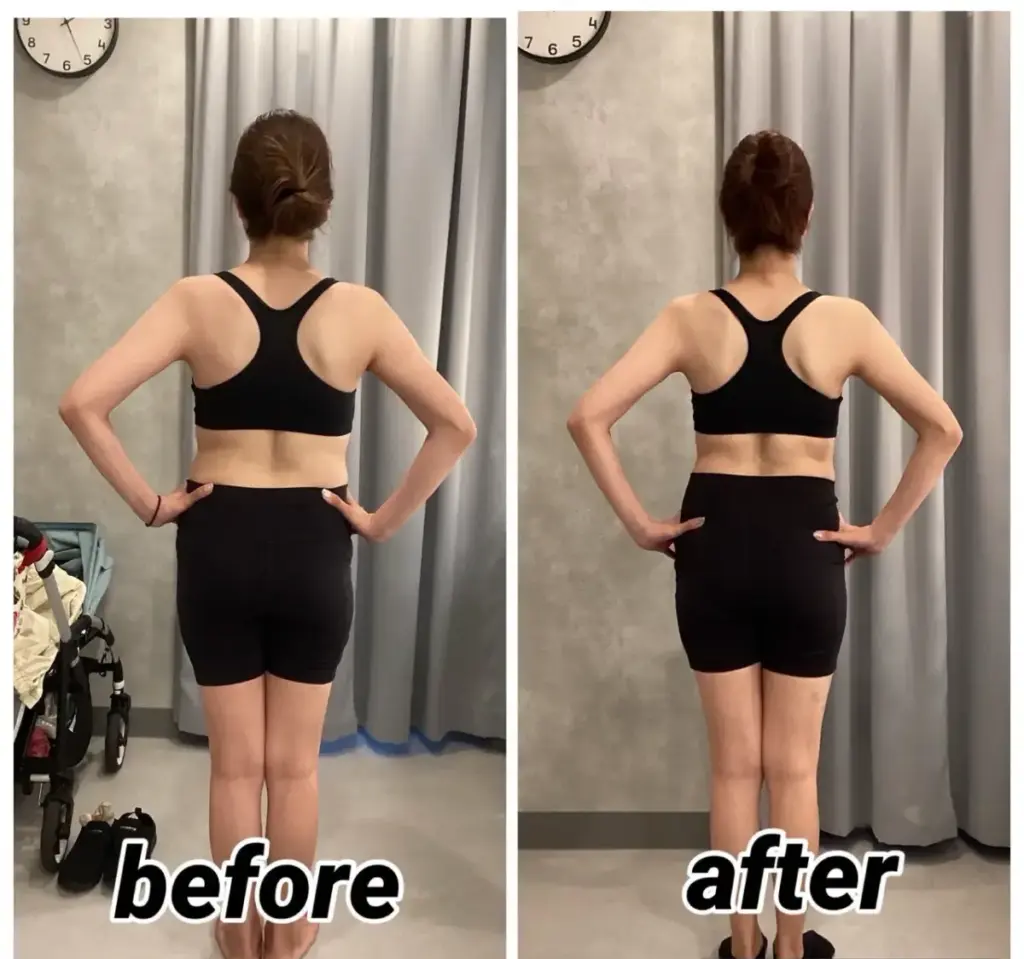 UNDEUX SUPERBODY LIFE4ヶ月の結果、背中・腰まわり・脚ラインが大きく変わった後ろ姿のビフォーアフター（LYFTOFF-WOMAN編集部オリジナル）