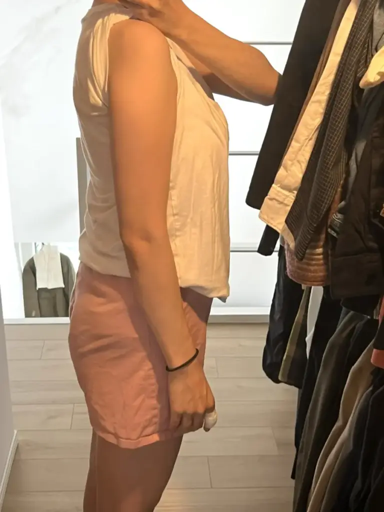 UNDEUX SUPERBODY LIFEの4ヶ月トレーニングで引き締まった二の腕（右）のビフォーアフター写真｜LYFTOFF-WOMAN編集部オリジナル