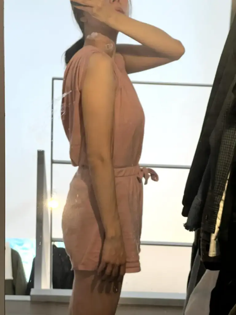 UNDEUX SUPERBODY LIFEの4ヶ月トレーニングで引き締まった二の腕（右）のビフォーアフター写真｜LYFTOFF-WOMAN編集部オリジナル