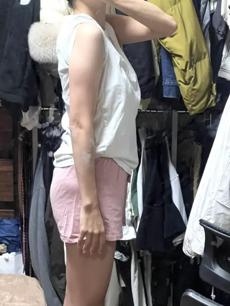 UNDEUX SUPERBODY LIFEの4ヶ月トレーニングで引き締まった二の腕（右）のビフォーアフター写真｜LYFTOFF-WOMAN編集部オリジナル