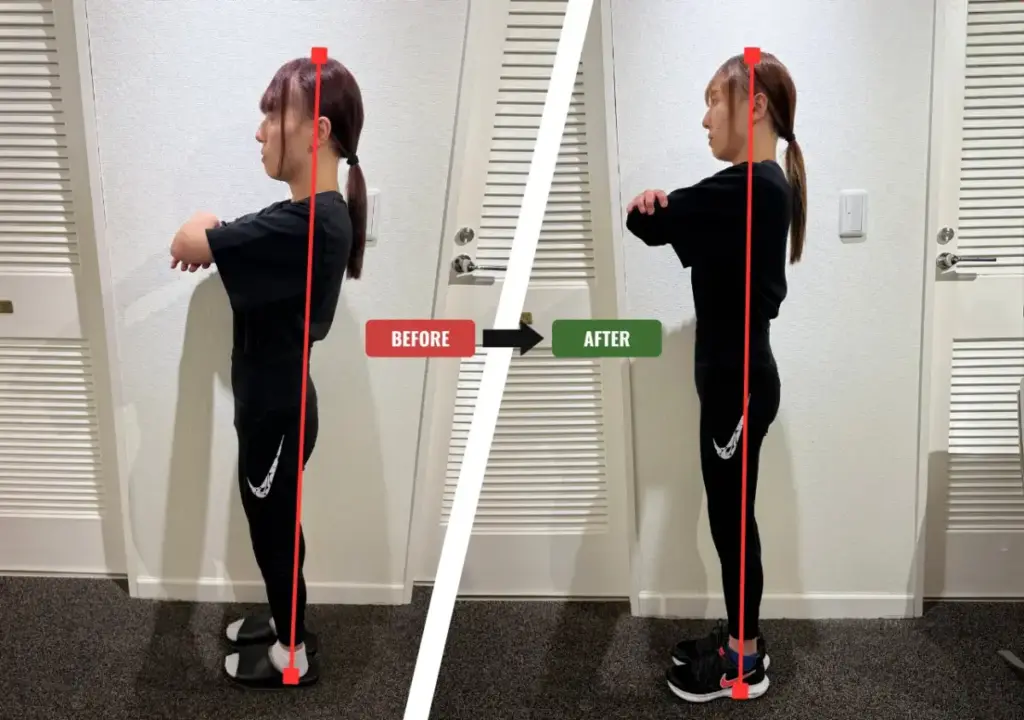 駅前筋肉留学GOで実際に3ヶ月姿勢改善に挑戦した際のビフォーアフター画像(姿勢全体)