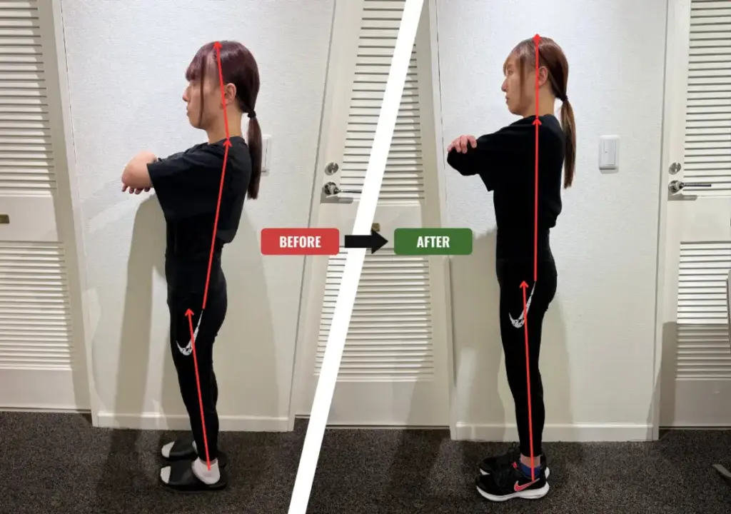 駅前筋肉留学GOで実際に3ヶ月姿勢改善に挑戦した際のビフォーアフター画像(姿勢全体)