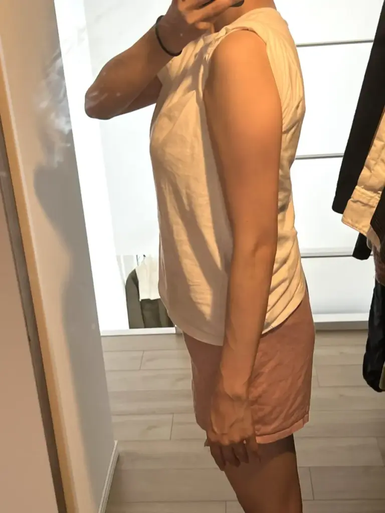 UNDEUX SUPERBODY LIFEで4ヶ月間の二の腕（左）の変化記録｜LYFTOFF-WOMAN編集部オリジナル