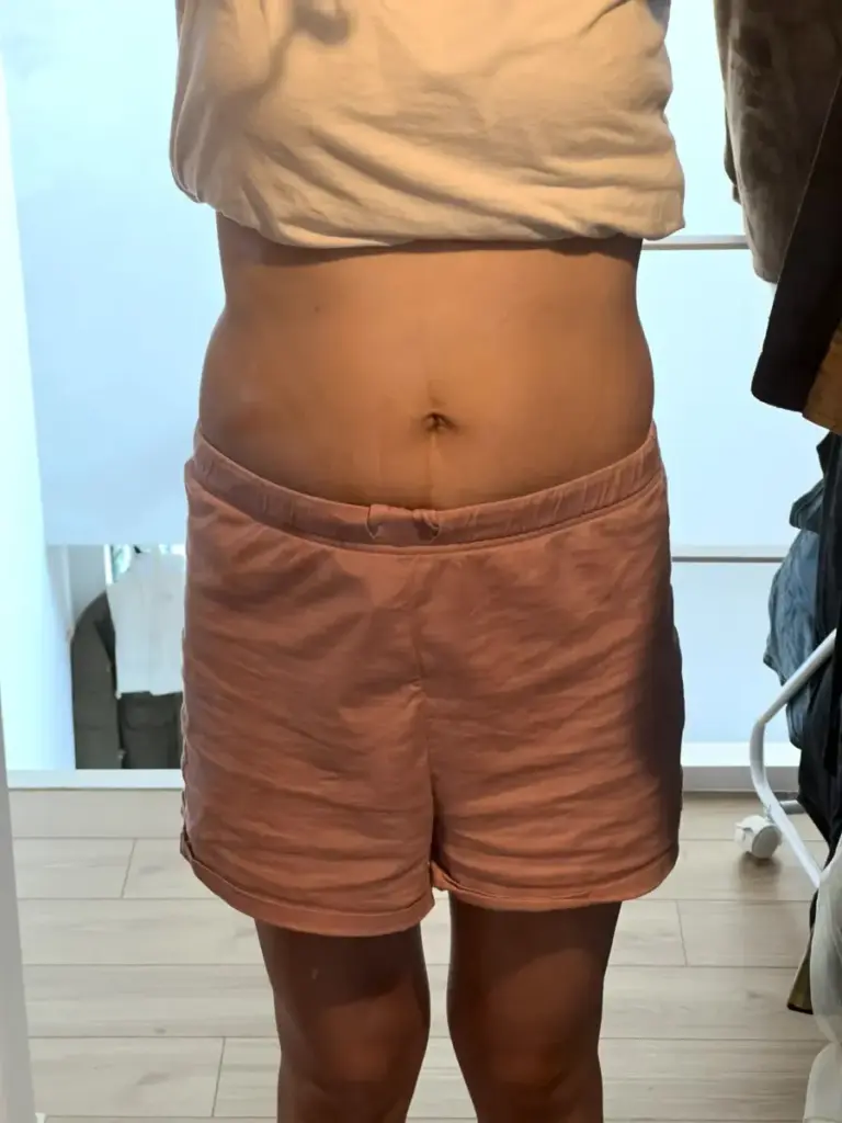 UNDEUX SUPERBODY LIFEの4ヶ月間でお腹の正面が引き締まっていく変化