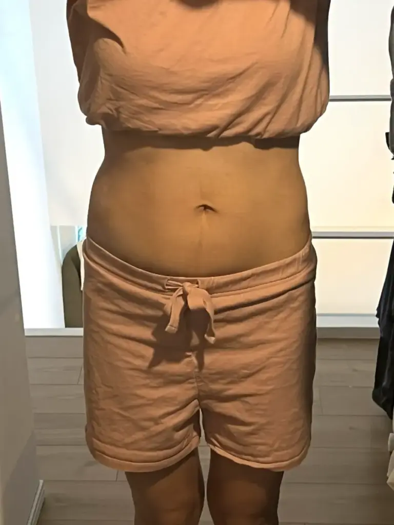 UNDEUX SUPERBODY LIFEの4ヶ月間でお腹の正面が引き締まっていく変化